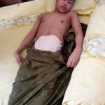 Tak ada biaya berobat, "TOMI" Warga Desa Lambai Terbaring selama setahun karena TBC Usus