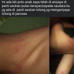 Viral !! Anak Asuh disalah satu Panti Asuhan Pulu Brayan Alami Kekerasan?